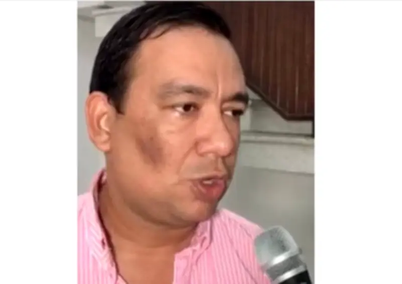 Atentado contra alcalde de Pedraza: Policía y víctima presentan versiones contradictorias