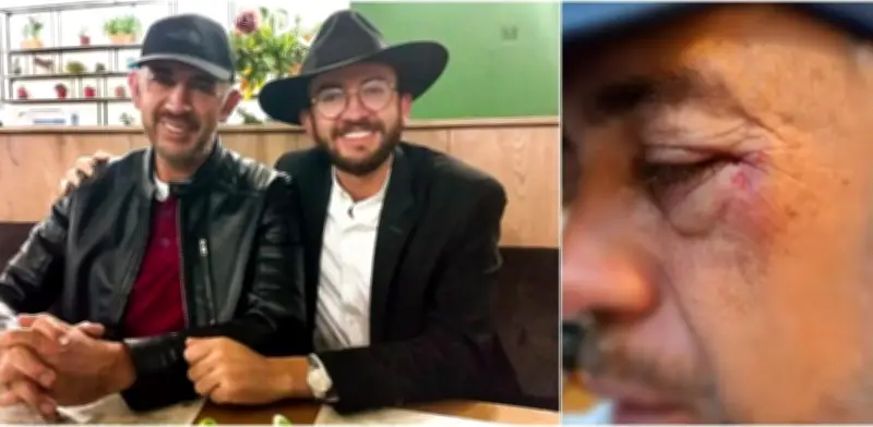 Brutal golpiza al padre de candidato a la Cámara en Boyacá tras discusión política en billar