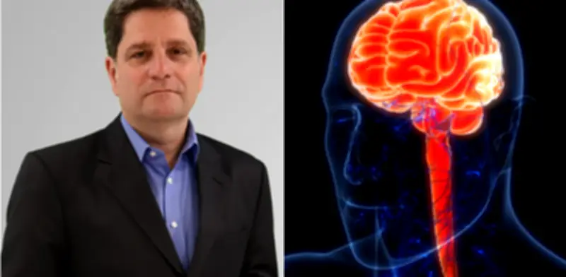 Cardiólogo revela pilares clave para prevenir accidentes cerebrovasculares y síntomas de alerta