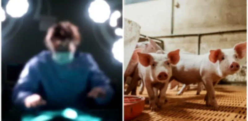 China logra estabilizar paciente con falla hepática usando hígado de cerdo modificado externamente