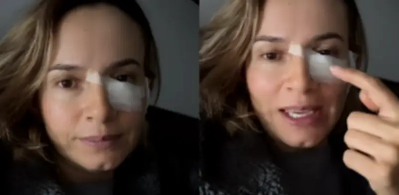 Colombiana comparte su lucha contra el cáncer de piel tras confundir un lunar con una simple mancha