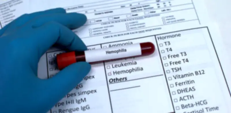 Crisis en tratamientos de hemofilia infantil: alerta por hospitalizaciones evitables tras muerte de niño