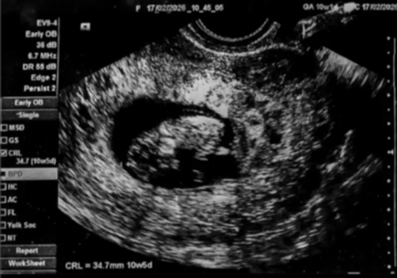 Error en redes del Fondo de Adaptación: publican ecografía personal en cuenta oficial