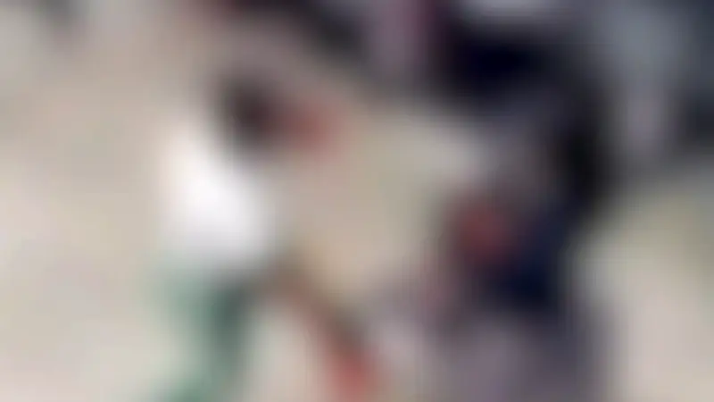 Estudiante de 15 años sufre fisura craneal tras pelea de boxeo en colegio de Huila