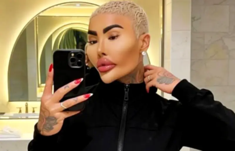 Fallece influencer británico tras cirugía estética: buscaba parecerse a Kim Kardashian