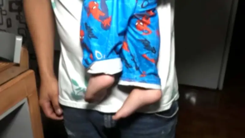 Familia con cuatro casos de hemofilia en crisis por falta de medicamentos en Colombia