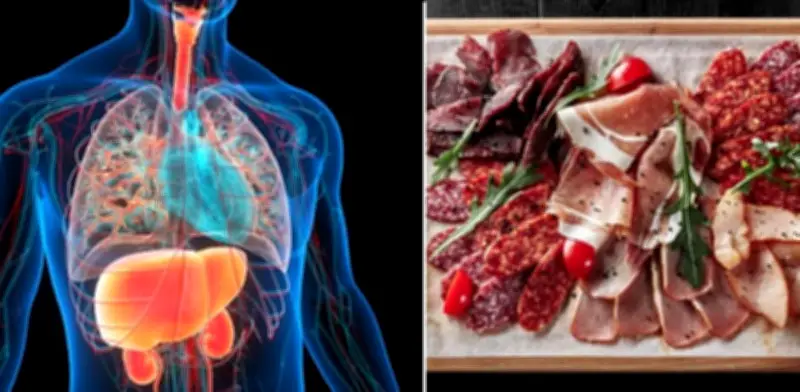 Hígado graso: por qué debe evitar salchichas, jamón y embutidos para proteger su salud