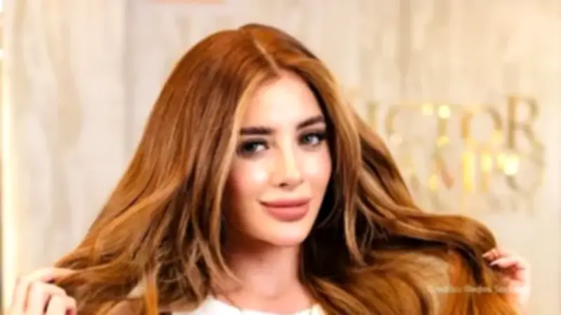 Hija de Marbelle sufre accidente doméstico con tacón que se incrusta en su nariz