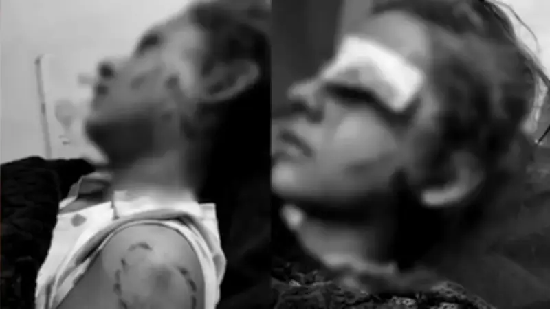 Hombre con antecedentes apuñaló y mordió a niña de 11 años en Suba: familia exige intento de homicidio