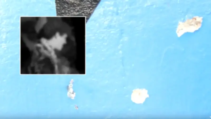 Identidad y estado de salud de estudiantes europeos heridos en tiroteo del Carnaval de Barranquilla