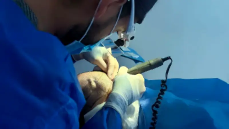 Implantes capilares en Colombia: clínicas más buscadas y tendencias actuales