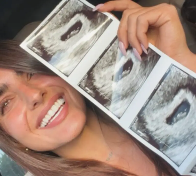 Isabella Ladera, ex de Beéle, anuncia su embarazo con emotiva sesión fotográfica