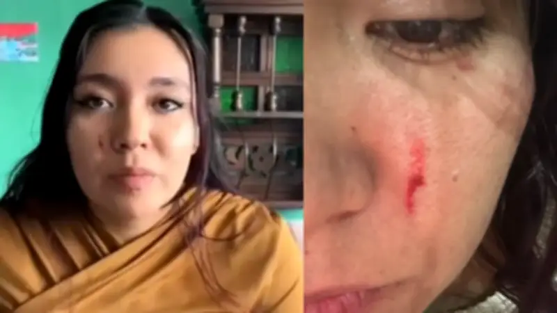 Joven denuncia agresión sexual en almacén de Bogotá: desconocido la golpeó en partes íntimas