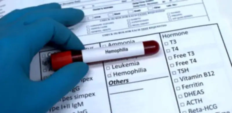 Médicos alertan sobre graves barreras en acceso a medicamentos para niños con hemofilia en Colombia