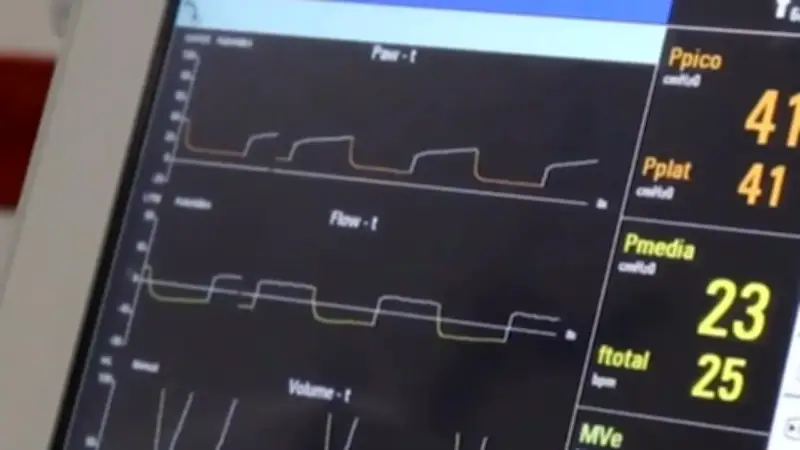 Niño con hemofilia en estado crítico tras dos meses sin medicamentos vitales