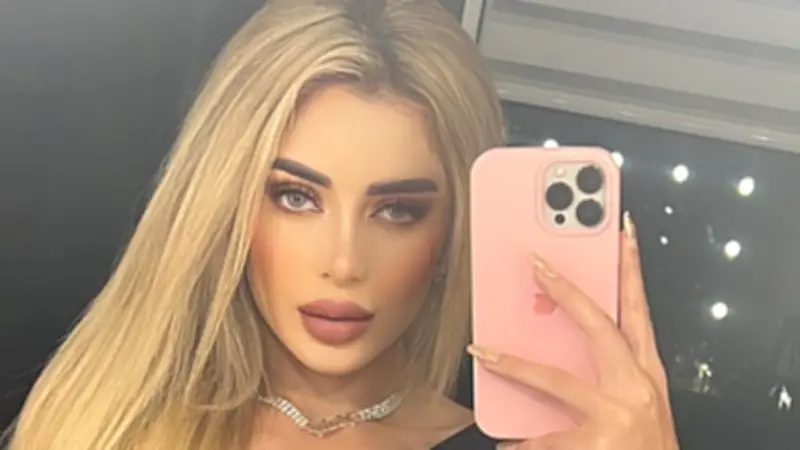 Rafaella Chávez, hija de Marbelle, sufrió accidente doméstico que le causó herida en la nariz