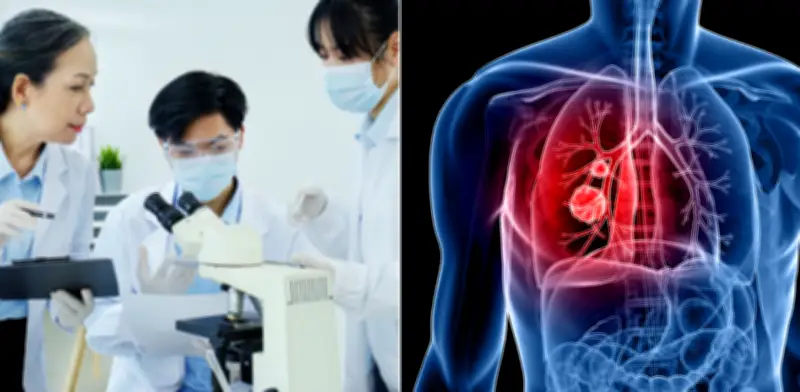 Sensor óptico chino detecta cáncer de pulmón temprano con análisis de sangre