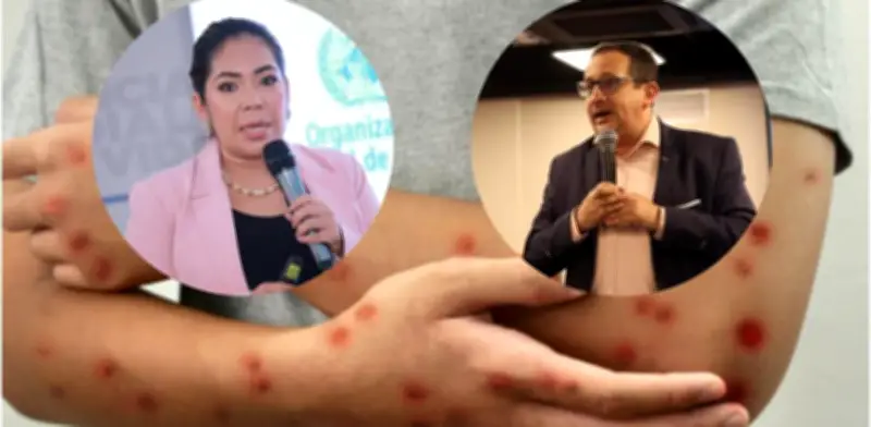 Subsecretario de Salud de Bogotá denuncia presión del INS para rectificar tuit crítico sobre sarampión