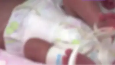 Bebé prematura con cardiopatía congénita enfrenta barrera de EPS para atención en Cartagena