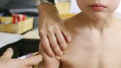 Choque de versiones entre Ministerio y Secretaría de Salud de Bogotá por caso de sarampión