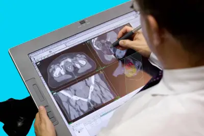 Colombia implementa por primera vez braquiterapia de próstata en tiempo real