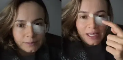 Colombiana comparte su lucha contra el cáncer de piel tras confundir un lunar con una simple mancha