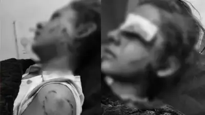 Hombre con antecedentes apuñaló y mordió a niña de 11 años en Suba: familia exige intento de homicidio