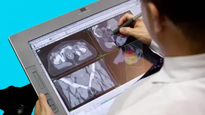 INC marca hito en Colombia con innovador procedimiento contra cáncer de próstata