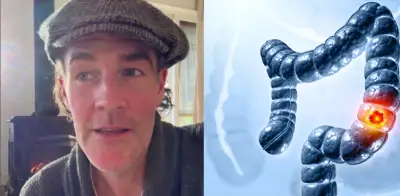 James Van Der Beek fallece a los 48 años por cáncer de colon: síntomas y alertas tempranas