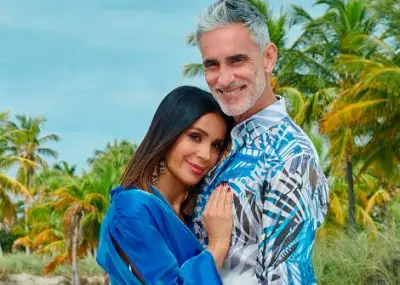 Miguel Varoni revela su transformación física tras cirugía de rejuvenecimiento