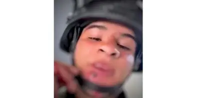 Soldado mexicano muestra herida de bala en rostro tras operativo contra 'El Mencho'