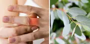 Eucalipto: La planta medicinal que alivia la artrosis y regenera músculos