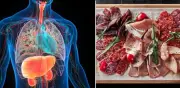 Hígado graso: por qué debe evitar salchichas, jamón y embutidos para proteger su salud