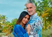 Miguel Varoni revela su transformación física tras cirugía de rejuvenecimiento