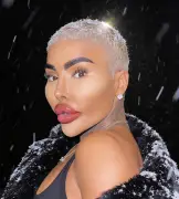 Muerte del influencer 'Rey de los labios' Jordan James Parke conmociona a sus seguidores