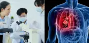 Sensor óptico chino detecta cáncer de pulmón temprano con análisis de sangre