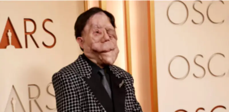 Adam Pearson y la neurofibromatosis tipo 1: la enfermedad que despertó conciencia en los Óscar 2026