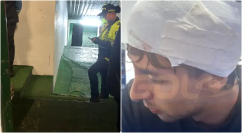 Altercado violento en túnel de estadio deja herido a jugador de Boyacá Chicó