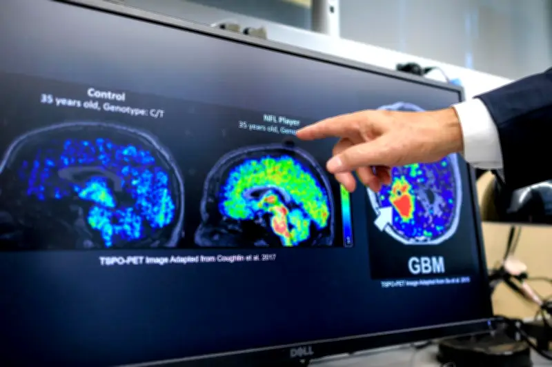 Análisis de sangre podría predecir riesgo de demencia décadas antes de los síntomas