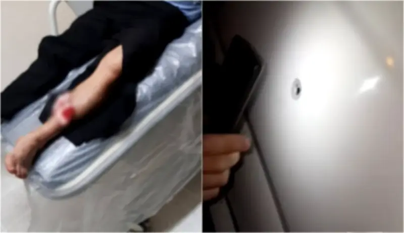 Ataque a bala contra buseta de Radio Tax deja conductor herido en vía Bucaramanga-El Playón