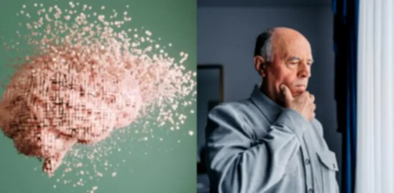 Carbohidratos refinados aumentan riesgo de Alzheimer según estudio español