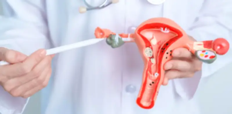 Cáncer de cuello uterino: segundo más frecuente en mujeres colombianas, prevenible con diagnóstico oportuno