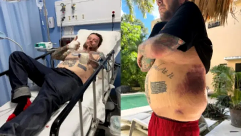 Corey Harrison de 'El Precio de la Historia' pide ayuda tras grave accidente en México