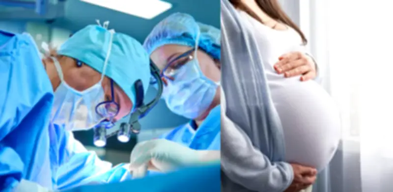 Corte Constitucional ordena a EPS cubrir reversión de ligadura de trompas