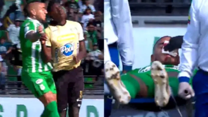 Cristian Arango sufre grave accidente en estadio y es evacuado en ambulancia