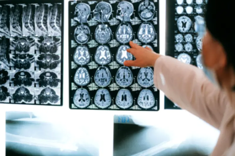 Dos fallecidos por brote de meningitis sin precedentes en Inglaterra