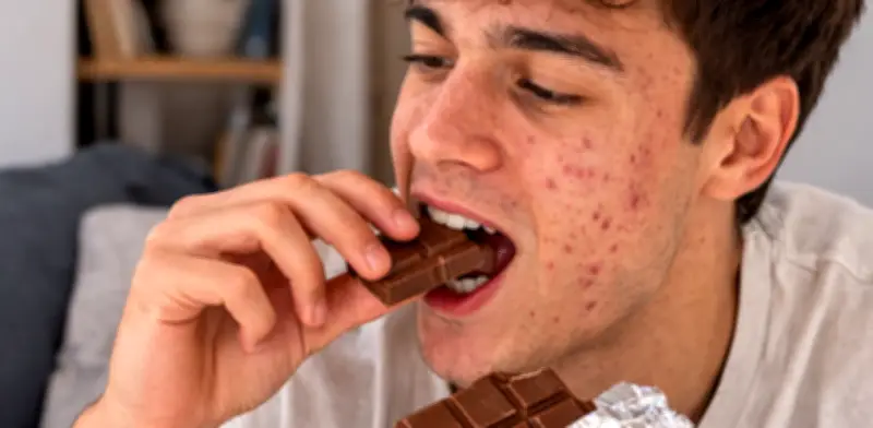 ¿El chocolate causa acné? La ciencia analiza una relación aún sin confirmar