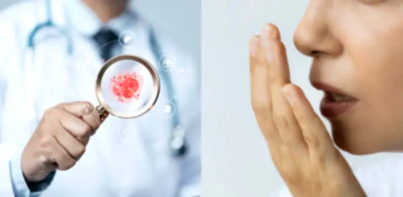 El mal aliento persistente puede ser señal temprana de varios tipos de cáncer