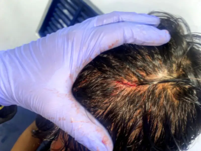 Escándalo en la Liga Betplay: Diego Novoa de Millonarios acusado de agresión brutal contra jugador de Boyacá Chicó