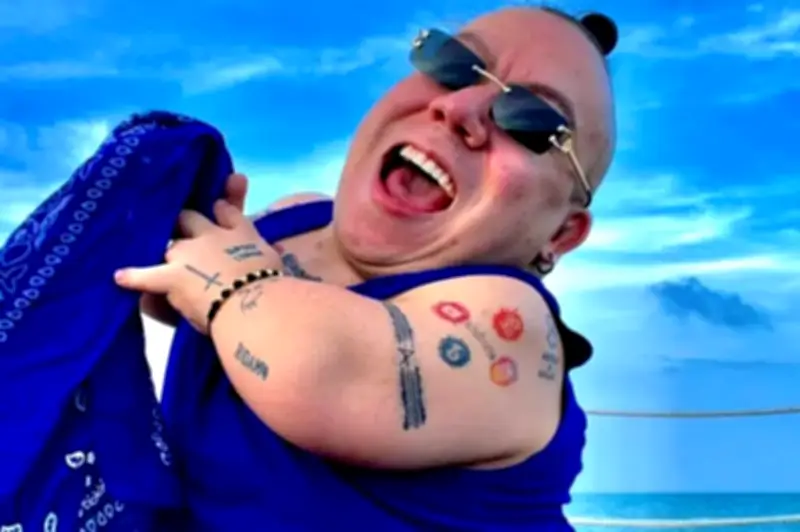 Fallece el influencer paisa Alejo Little a los 33 años tras complicaciones de salud